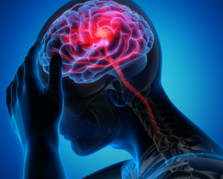 Wellness Wednesday: The 411 on Migraines with Dr. Daniel Van Engel, MD. 