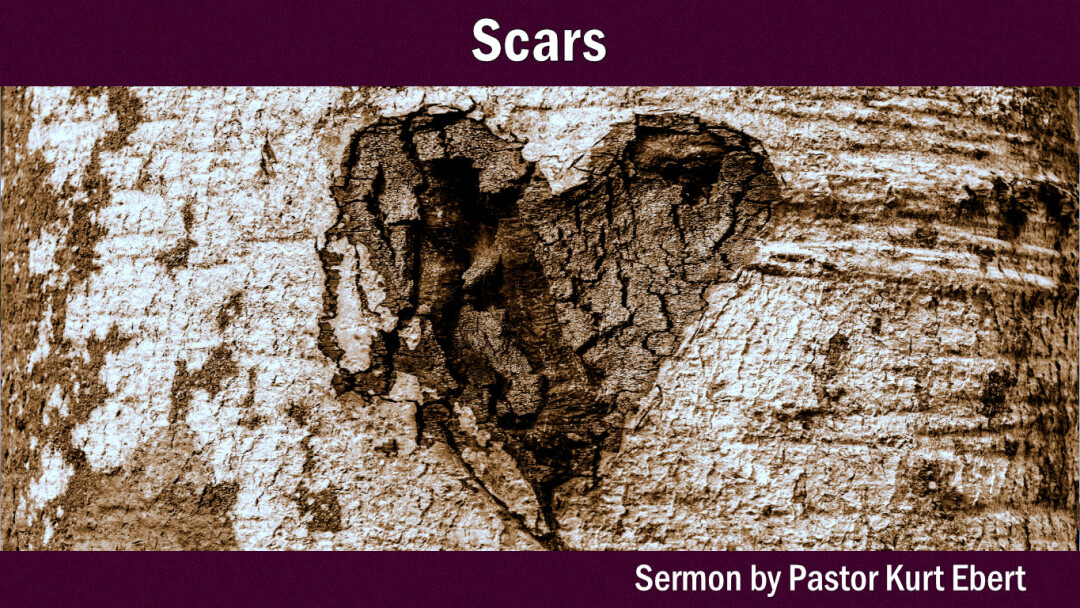 Introduction (SCARS)