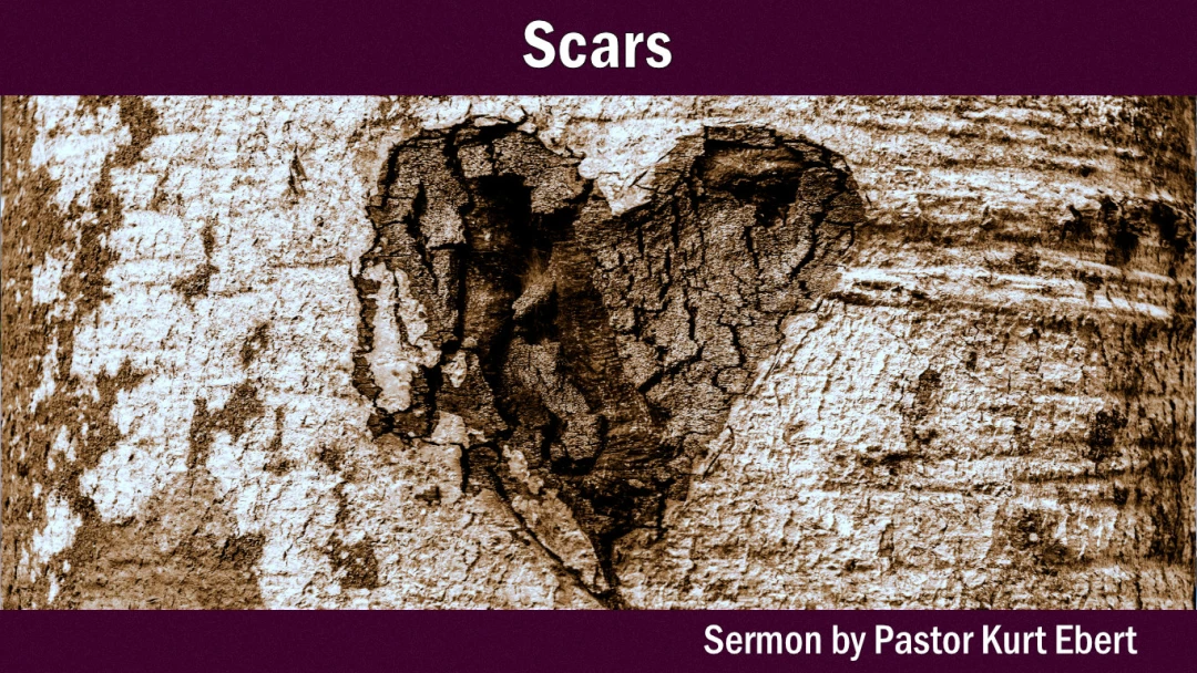Introduction (SCARS)
