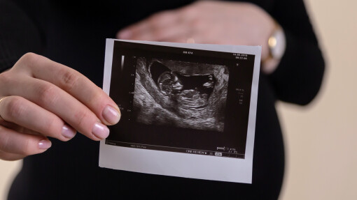 Defining Life From Science, Not Philosophy